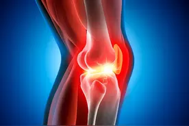 痛风石大部分消除，危重痛风患者重获新生图片