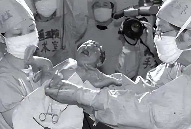 著名专家预言：试管婴儿寿命仅40年，那首例试管婴儿如今怎样了？