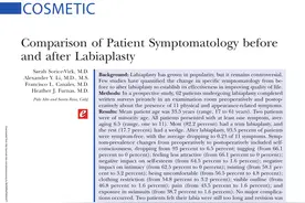 小阴唇整形详解图片