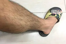 为何有的男性腿毛旺盛，有的却“光秃秃”？这多半与5个方面有关图片