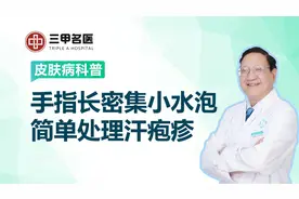 手指长密集小水泡特别痒，可能是汗疱疹，可以这样简单处理图片