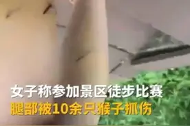 游客被十余只猴子抓伤，瓦屋山景区：欢迎贡献金点子管理猴群图片