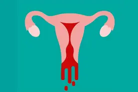 月经淋漓不尽，这3+5个因素是关键，要小心了！图片