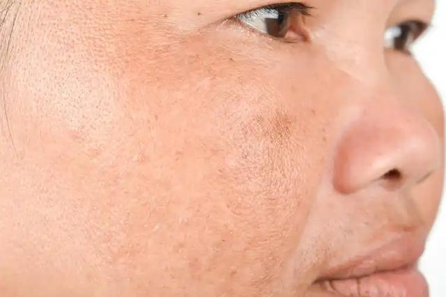 女性有没有衰老，“上半身”会说话，若一个没中，恭喜你还年轻！