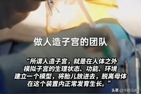90后医生研究“人造子宫”，动物试验已成功，难道男性也可怀孕？图片