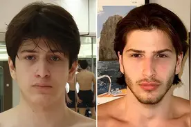 欧美男孩痴迷变帅，十几岁拿锤子敲脸整形，太丑会被劝去自杀图片