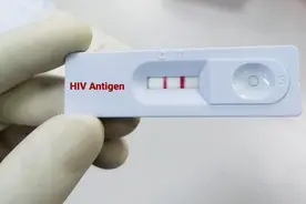 不洁性交后，身体出现这五种异常，可能是艾滋病症状，应尽早就医图片