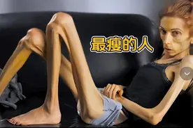 世界上最瘦的几位女人,体重仅仅20公斤,网友:上辈子是干尸吧?图片