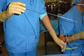 捐卵还贷的女大学生：15分钟，不知道取了多少个卵子图片