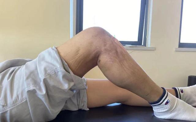 离死亡最近的3个月，肿瘤患者会出现5个症状，希望你一定都没有！