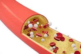 医生告诫：起床后若有这5个反应，或说明血管已堵塞，老人要当心图片