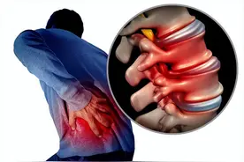 导致腰部疼痛的原因有哪些？可能和5种病情有关！记得对症下药图片