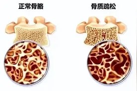 药补不如食补，对骨骼特别好的10种营养成分，常吃骨骼和关节越来越健康！图片