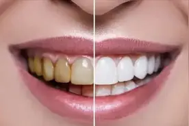 每天喝它=给牙齿上刑！医生急喊：快放下你手里的'健康'饮料图片