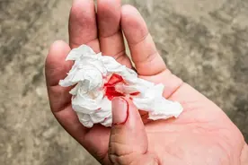 痔疮便血，你们觉得不管它最严重会怎么样？图片