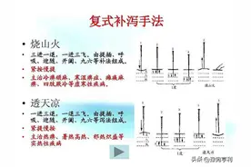 针灸的手法图片