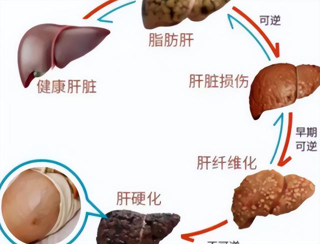医生提醒：吃他达拉非时别碰这4样东西，小心引发猝死危险！
