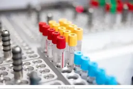 全球仅一例？某地发现比熊猫血还珍稀的血型图片