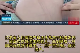 怀孕21周时胎儿小脚丫掉了出来 为保胎妈妈以臀高位姿势卧床1个月图片