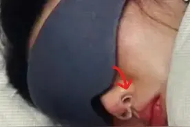 金晨《花少》疑戴隆鼻矫正器睡觉，网友辣评：鼻子做得太差图片