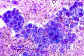 肿瘤医生：预示癌症的20个症状，一旦发现要当心！图片