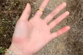 被蛰出“荨麻疹”却吃上瘾？这株全网最野的草，你认识吗？图片