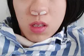 用对鼻炎药解决鼻炎事半功倍！3款亲测国货确实好用！入坑不亏！图片