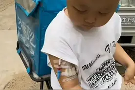 神母瘤小孩，可以救治吗？图片