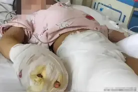 广东男孩被炸伤，不仅截肢右眼还全瞎，网友：活该，家长罪有应得图片