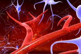 瘀血越重，病越多！3招帮你打开排瘀“开关”，淤堵一除全身轻松图片