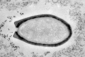 “僵尸病毒”被分出！人类最担心的要来了，科学家警告：北极大变图片