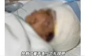 7岁男孩遭3只大型犬撕咬，左耳都没了！仅收到5万赔偿图片