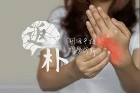 瘙痒人人都有，但这位华人学者做出了世界级的科学发现图片