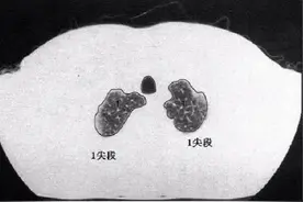 肺部CT分段解剖（更方便记忆）图片