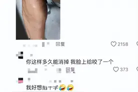 蚊子包能有多离谱!网友：都给姐叮成哆啦A梦了图片