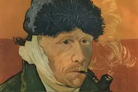 皮脂腺囊肿手术切除记录图片