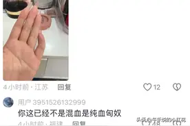 惊讶！小拇指弯曲的人有可能是匈奴后代？网友：小时候以为是骨折图片