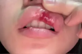 女孩正月里被父亲暴打后续：已回校将父亲拉黑，未来靠自己挣学费图片