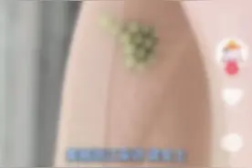 一出现就是14颗！网友：头皮发麻……图片