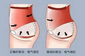 女性坚持做提肛运动，身体会发生什么变化？一次做多少合适？图片