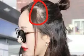 明星戴的假发片，你不会没看出来吧？别再秃头焦虑了！图片