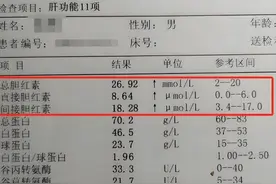 80%逆转的肝硬化患者，化验单有3个特征，希望你也有图片