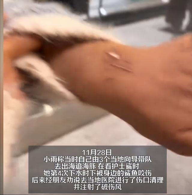 惊险！女子生理期潜水被鲨鱼咬伤，专家：血腥味有刺激