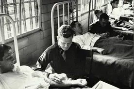 糙皮症听过吗？人类怪病之糙皮症的由来与覆灭图片