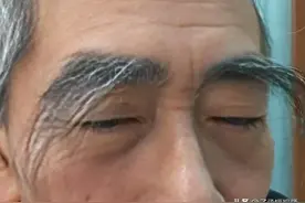 中老年男性，眉毛突然变长，是好还是坏？很多人还蒙在鼓里！图片