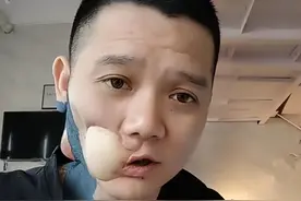 “槟榔四巨头”：两年死四个，一天狂炫3包槟榔，有一个割舌保命图片