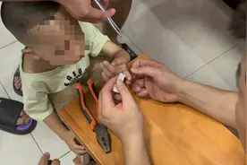 湖北宜昌：小男孩手指“被套牢” 消防员紧急“解套”图片