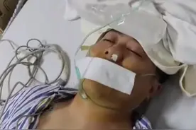 男子抠鼻成瘾竟抠进手术室！妻子无奈发视频警示：别再抠了！图片