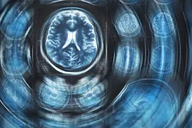 很多膝关节病患者是被核磁吓倒，而不是被真正的疾病击倒图片