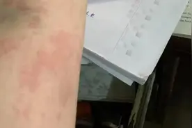 捉它泡酒祛风湿？男子喝完2小时后，家属拨打了120图片